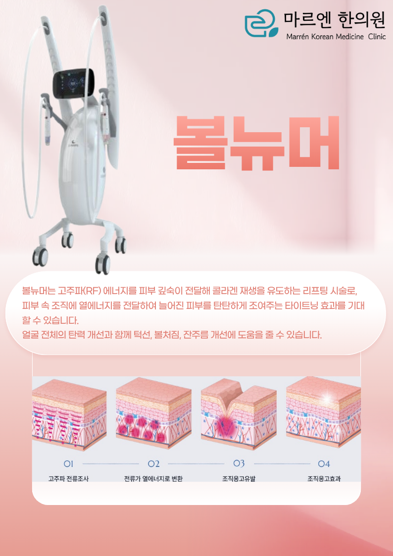 볼뉴머 시술 안내