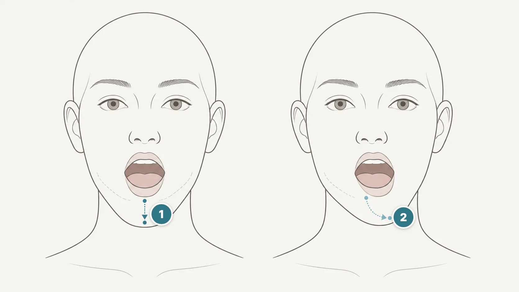 입을 벌릴 때 곧게 내려가는 경우와 한쪽으로 치우치는 경우 비교